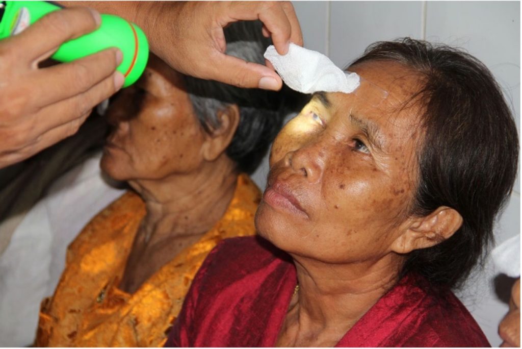 Augenuntersuchung einer Patientin, Laos