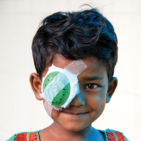 Boy smiling with Eye patch